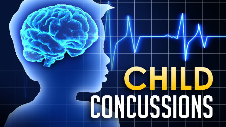 Child Concussions - 720