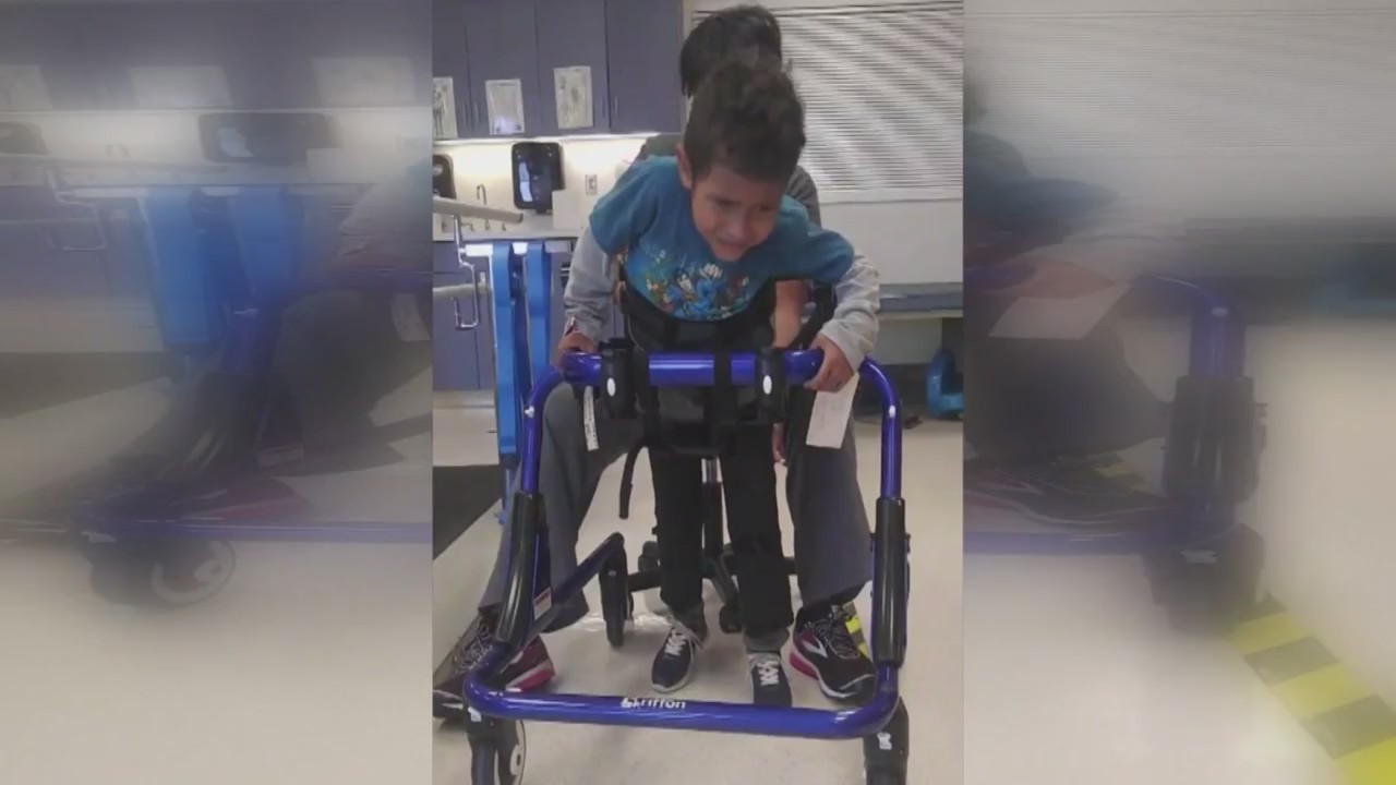 Texas_has_highest_Acute_Flaccid_Myelitis_9_20190104001259