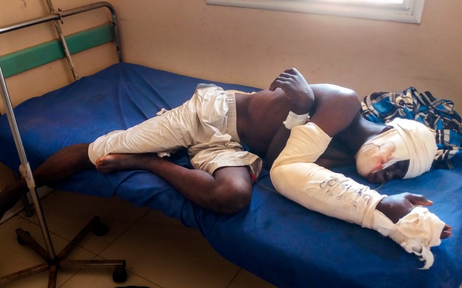 FILE - Saga Saganla, 30, from Diawely, lies on his bed at Somine Dolo hospital in Mopti, Mali, Friday June 24, 2022. Saganla survived an attack by nearly 100 jihadis on motorbikes. Top human rights groups have released new reports in which they documented cases of “war crimes” against civilians in the violent conflict in Africa’s Sahel region where rebels are increasingly fighting in communities under siege. The reports focusing on Burkina Faso and Mali were separately released this week by the Human Rights Watch and Amnesty International. (AP Photo/ Hamidou Saye, File)